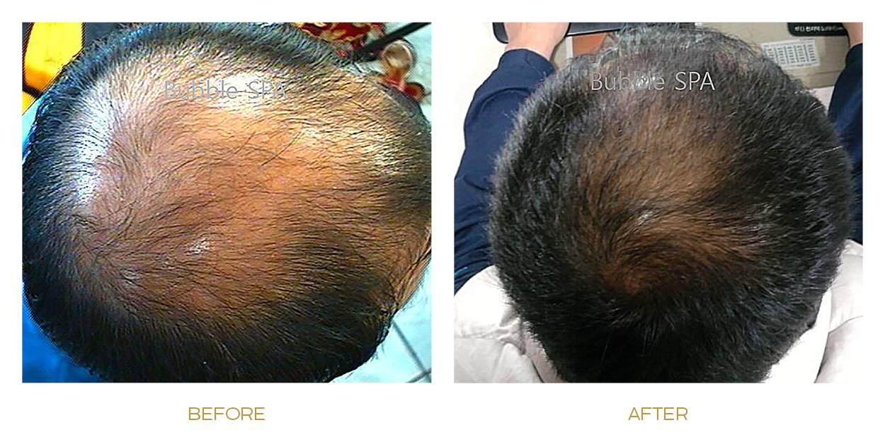 cell nutrition therapy before after picture