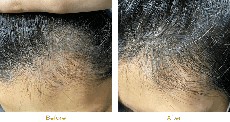 DNA Activator before after pic