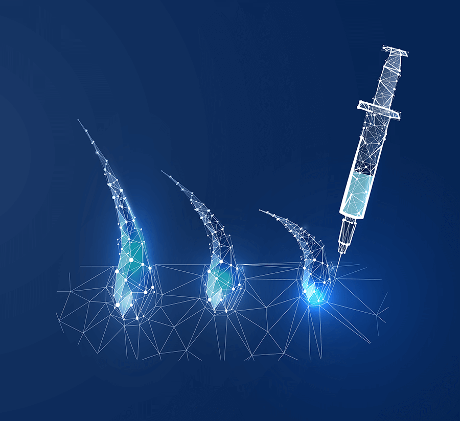 Papilla_PRP_injection 2