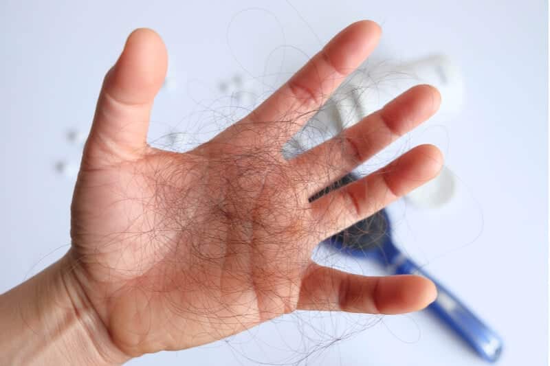 hair loss caused by poor diet