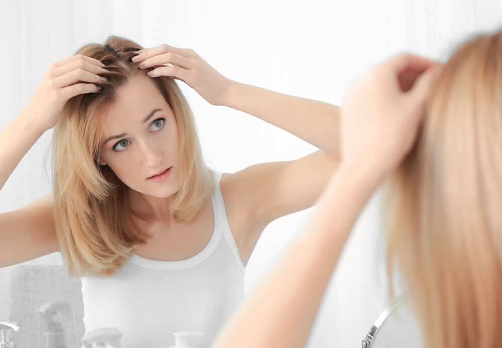 hair loss in ladies