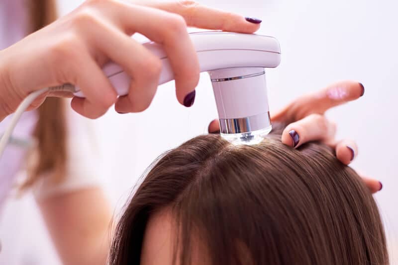 hair loss treatment