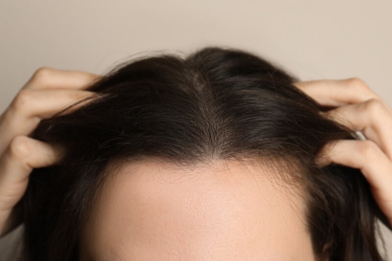healthy hair loss treatments
