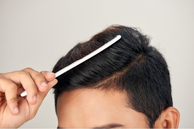 lifestyle changes to help hair loss