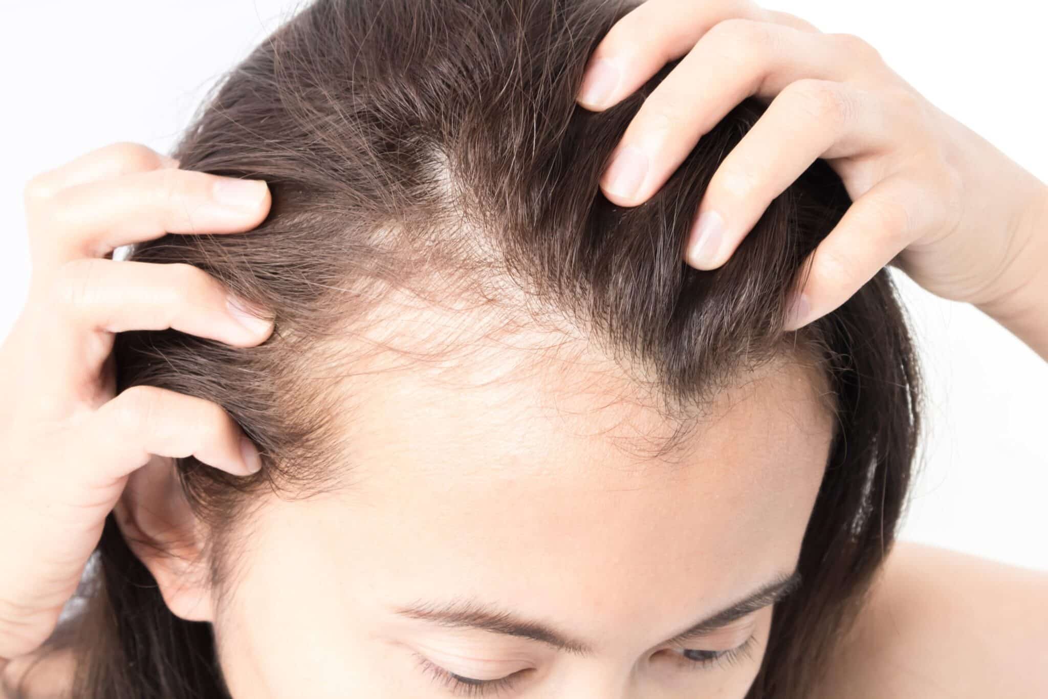papilla haircare hair thinning