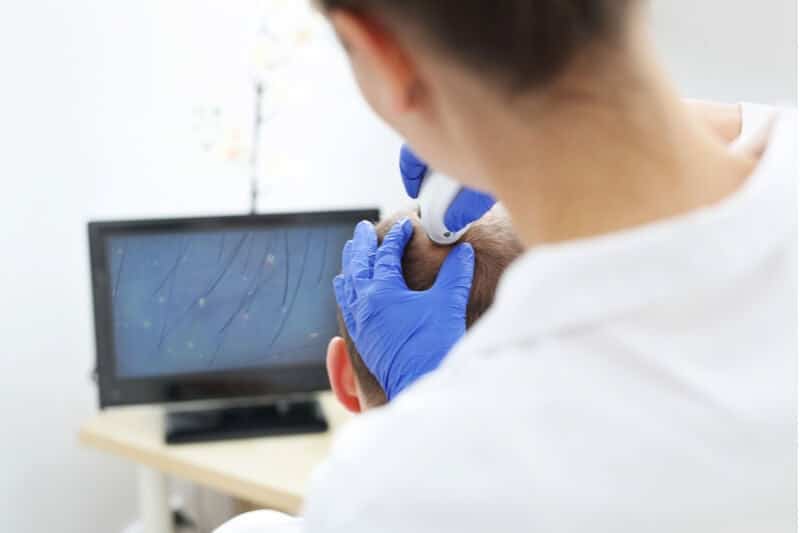 scalp treatment for hair loss in men