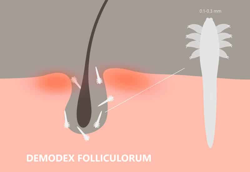 what are demodex hair mites