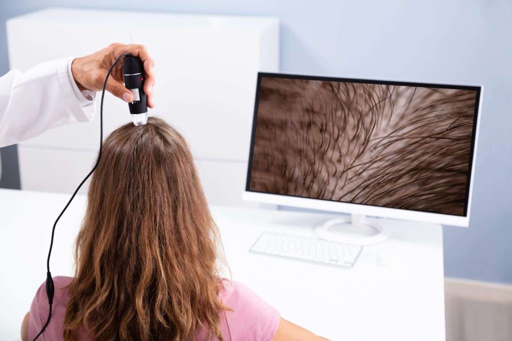 Woman undergoing non-invasive treatment for hair thinning in Singapore - Papilla by Kim Lim